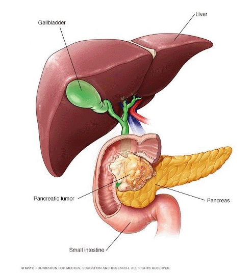 pancreatic cancer nectin-4